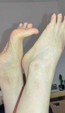 ϱ���Ľŵ������޵Ŀ���